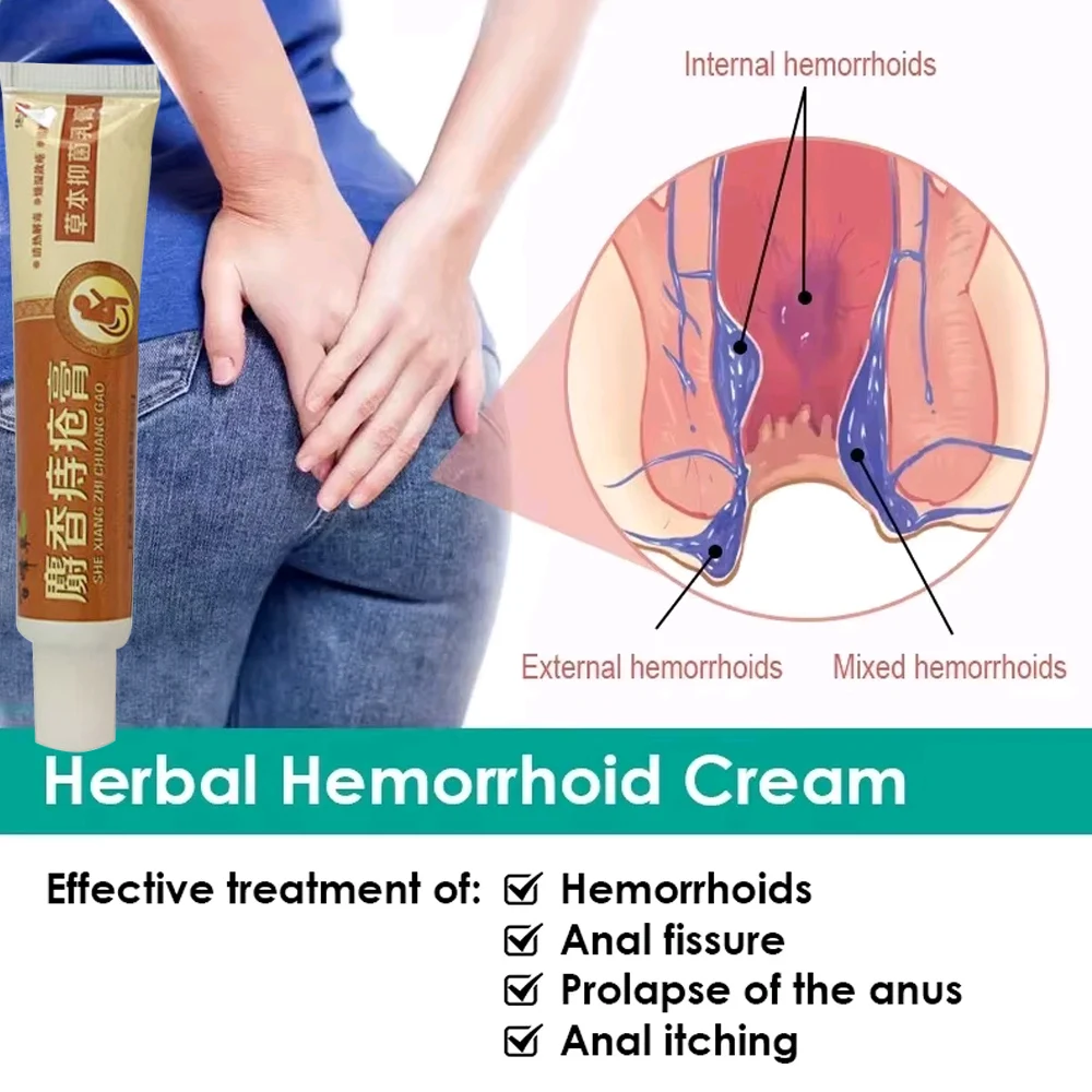 Musk Materials Hemorrhoids Ointment 18g Powerful Hemorrhoids Cream Internal Piles External Anal