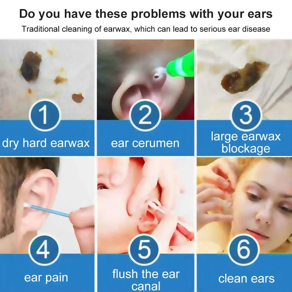 A cera de ouvido é uma grande protetora do canal auditivo e, geralmente, o  próprio corpo elimina o excesso. Mas é importante ficar de olho na cor. 😉  Veja quando é importante, image size:1000x1000