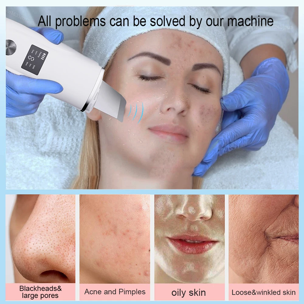 Ultrasonic Face Scrubber Facial Peeling Skin Scrubber Deep Facial Cleaning Spatula Acne Pore Ultrasonic Scrubber Facial Cleanser 2