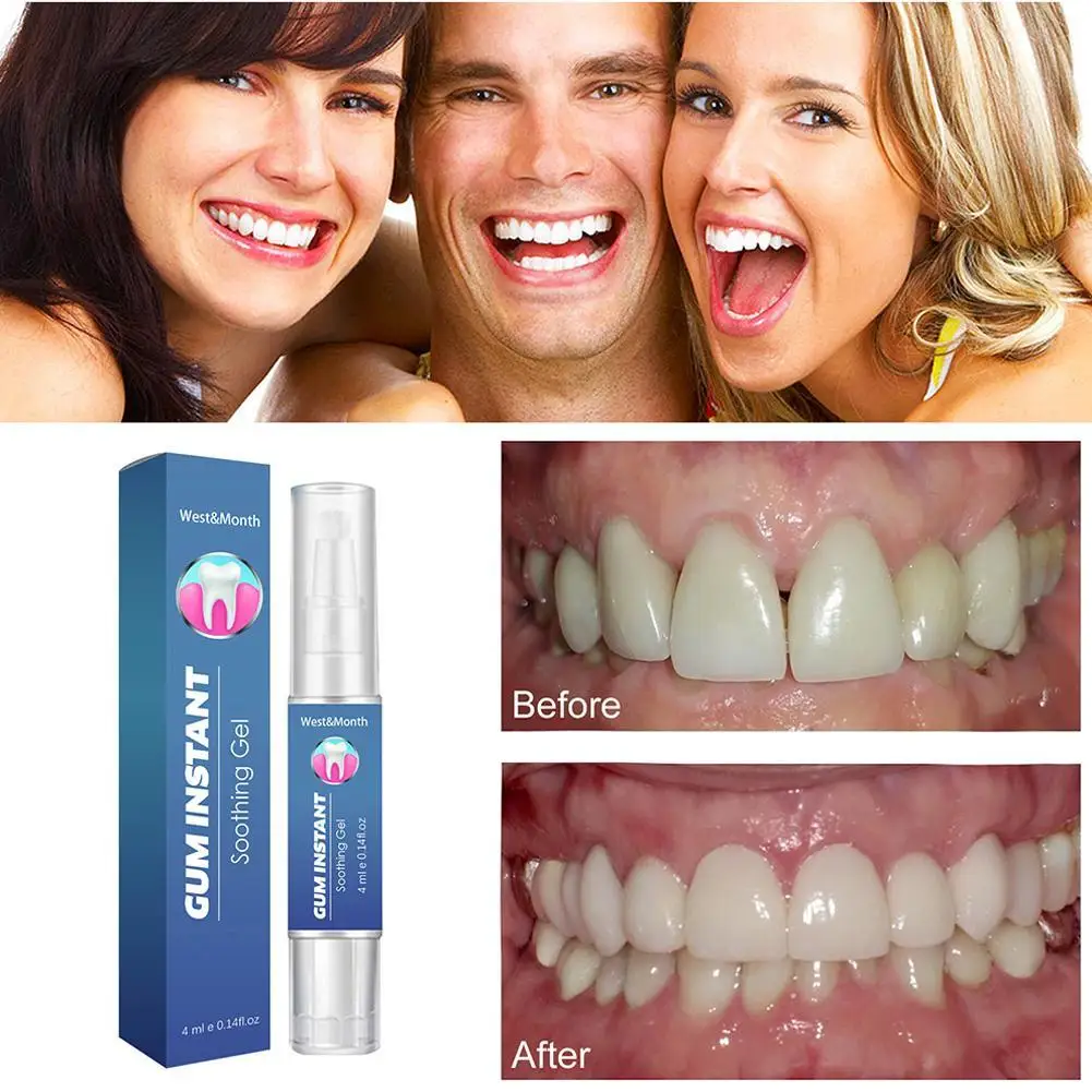 

Gum Soothing Gel Relieve Mouth Sores Blisters Periodontal Oral Treatment Antibacteria Pain Pharyngitis Care Gum Clean 4ml
