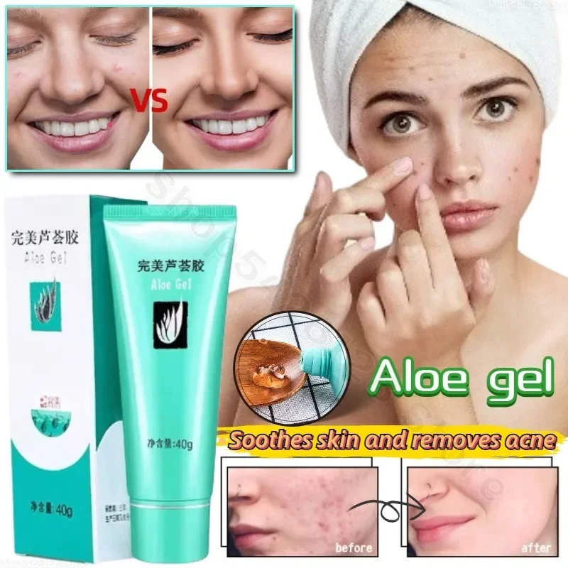 

Aloe Vera Gel Soothes Skin Hydrates Fades Acne Marks Removes Spots Sunburn Repair Cream Moisturizes and Beauty Skin Care 40g