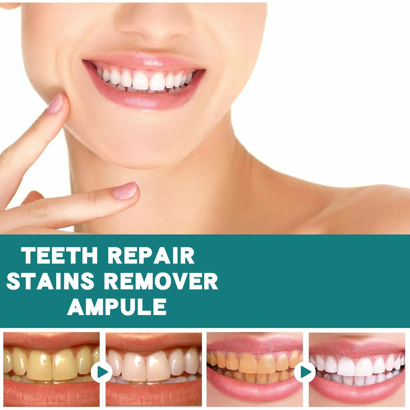 Tooth Whitening Jaysuing Repair Liquid Cleansing Stains Stains, Yellow Tooth Stains, Tooth Stains, Tooth Stains is most effective_voghion.com