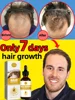 Óleos essenciais que promovem o rápido crescimento do cabelo e tratam a calvície e a queda de cabelo 1