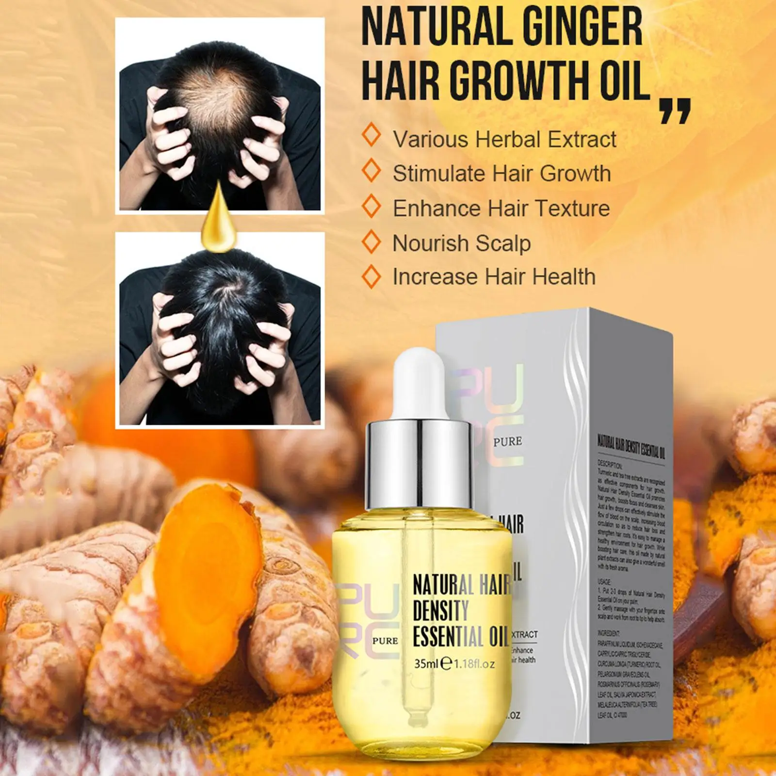 PURC 35ml Ginger Essence Oil Men Women Hair Loss Thinning Treatment Liquid Fast Regrowth Hair Density Essential Oil hair growth serum hair growth spray hair growth cream
