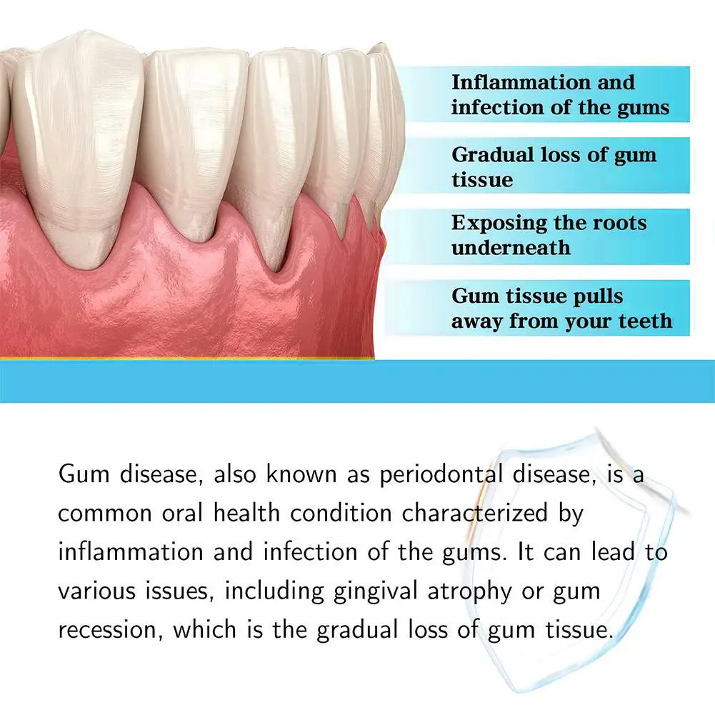 Gum Repair Drops Gingival Regrowth Drops Quickly Repair Of Cavities Caries Mousse Gum Treatment For Receding Gums Rejuvenate Your Gums With Ease