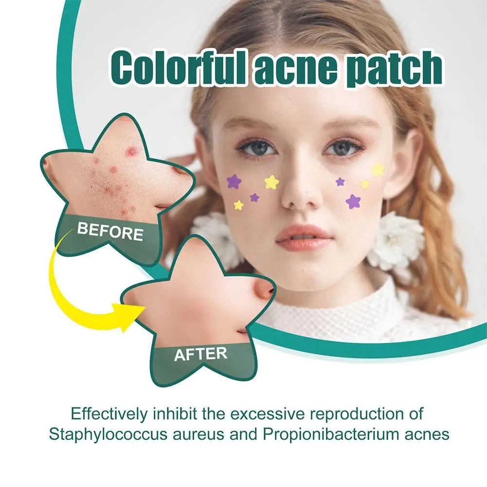 

New Star Pimple Patch Stickers Dazzling Colorful Face Care Acne Removal Concealer Face Spot Skin Care Sticker Beauty Makeup Tool