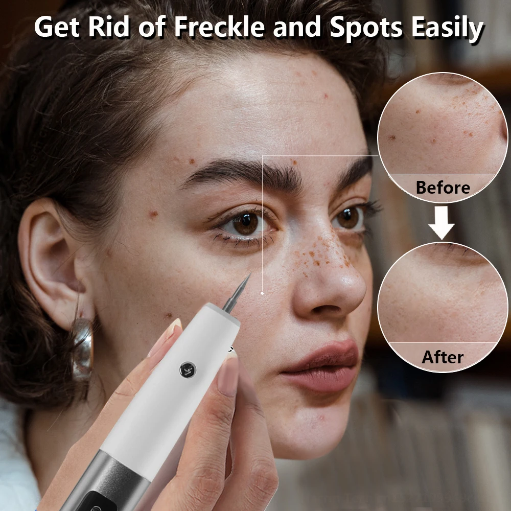 Laser Plasma Pen Electric Mole Remover Black Dots Wart Spot Freckle Dark Dot Nevus Flat Tattoo Skin Tag Removal