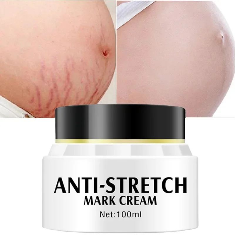 

Removes Stretch Mark Cream Postpartum Repair Fade Stretch Marks Prevent Obesity Lifting Firming Moisturizing Brighten Skin Care