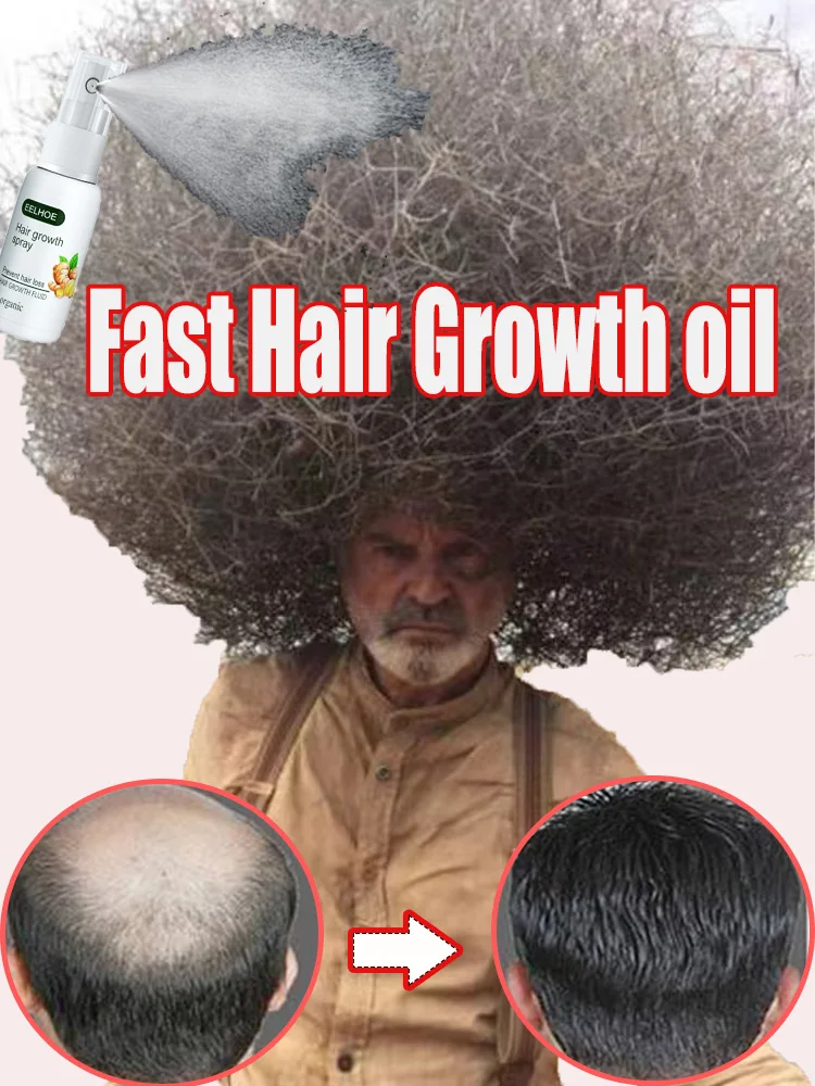 Fast Hair Growth Oil Natural Effective Anti Repair Baldness SeborrheicHereditary Postpartum Hairs Loss