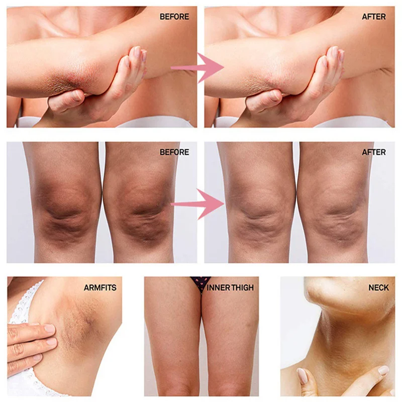 Body Whitening Cream Bleaching Private Parts Remover Melanin Lighten Underarm Knee Dark Moisturizing Brighten Skin Care_voghion.com