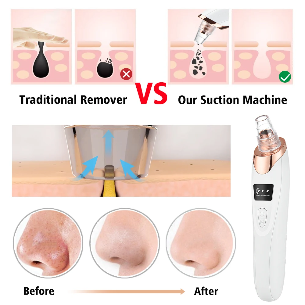 Electric Blackhead  Remover Vacuum Cleaner Facial Deep Cleansing Pore Cleaner Machine Black Spots Removal Face Skin Care Tools 3