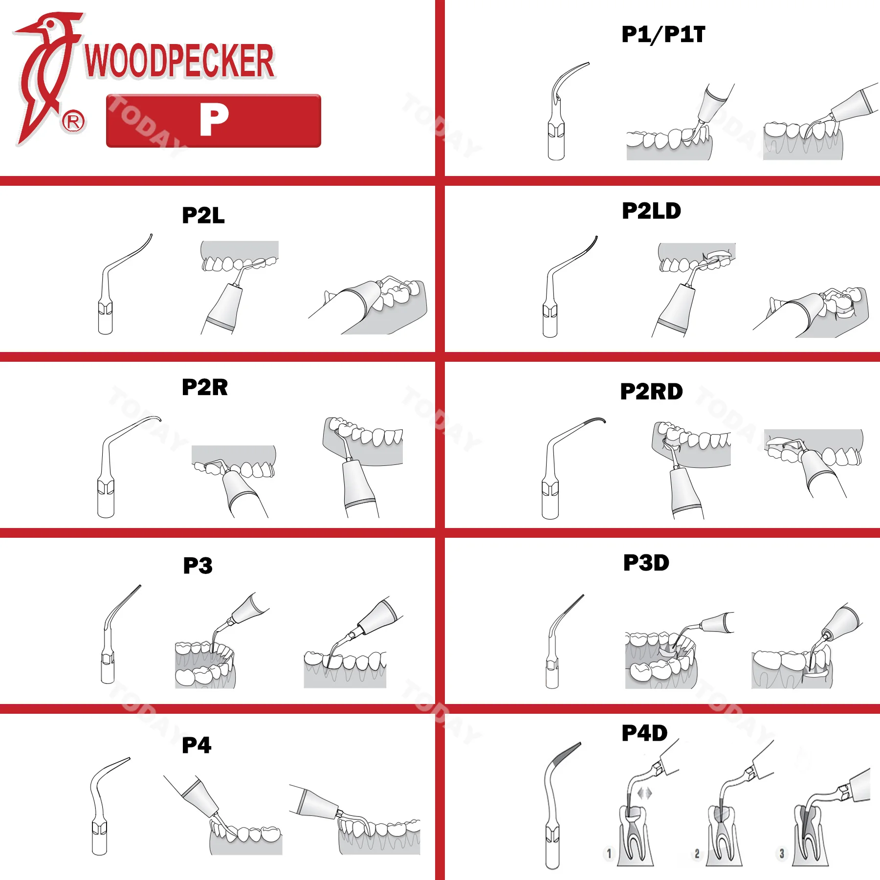 Рисунок 3 - Стоматологический Ультразвуковой скалер Woodpecker