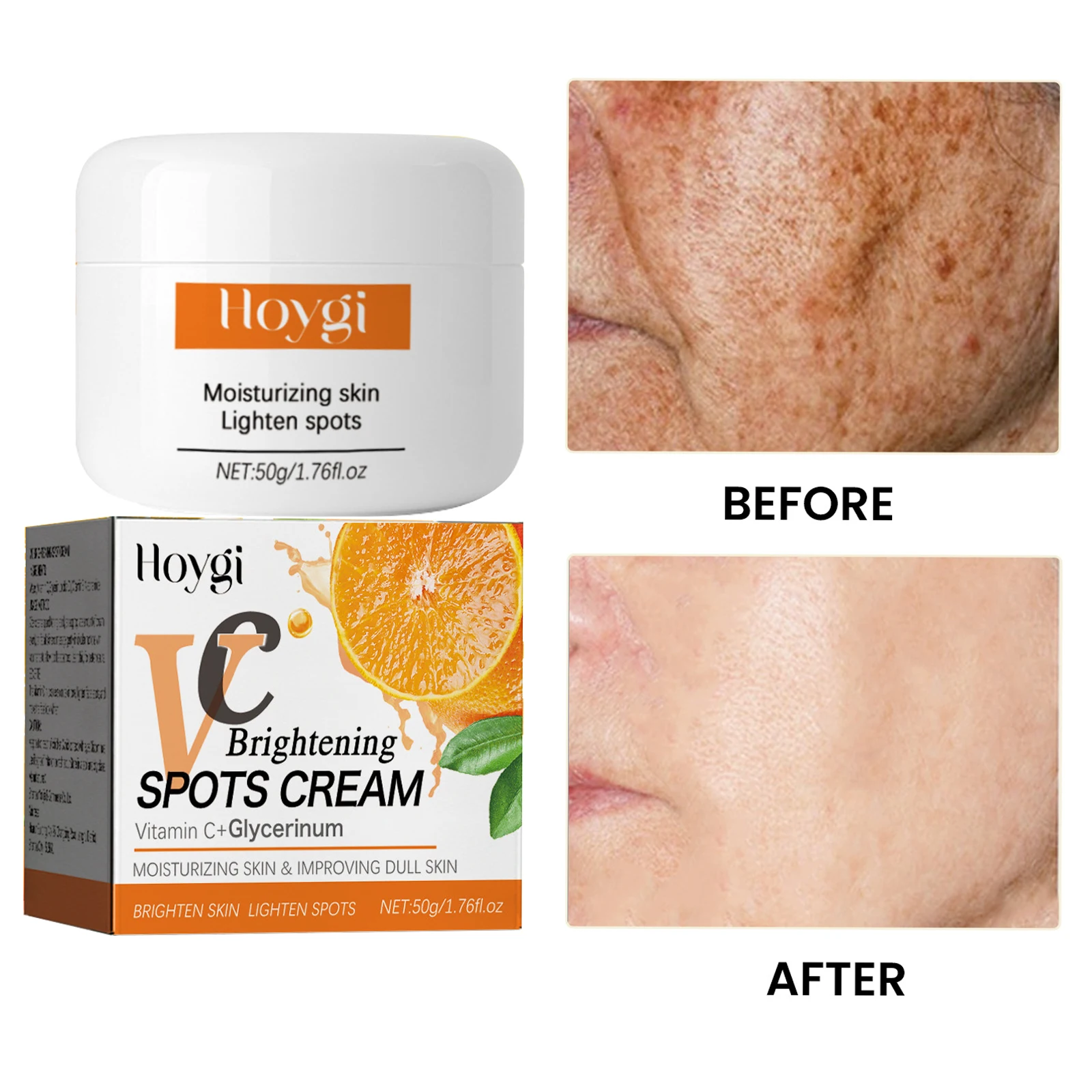 

Face VC Whitening Freckle Cream Remove Dark Spots Melanin Melasma Moisturizing Brighten Smooth Anti-aging Lifting Firming Skin