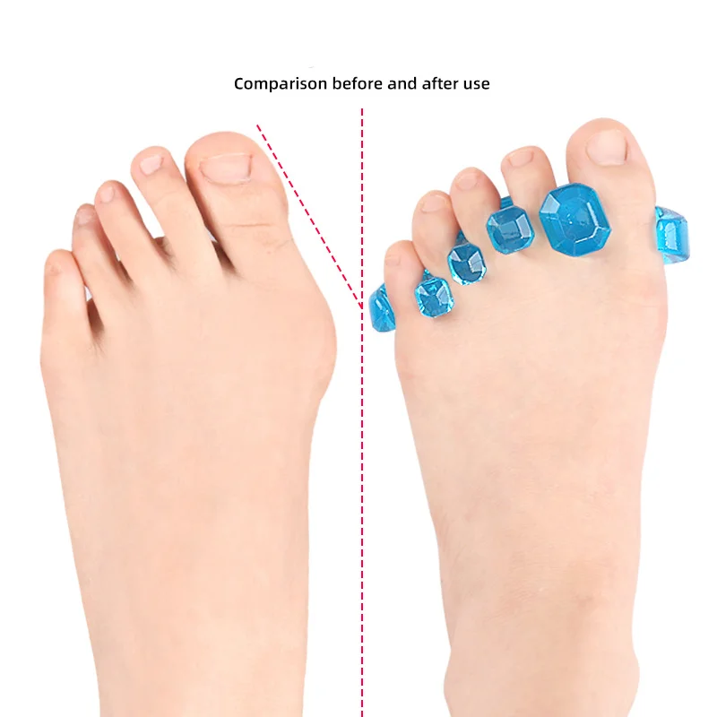 2Pcs=1Pair Fingers Gel Splitter Corrector Thumb Eversion Separator Five Toe Separation Overlapping Toe Foot Care Pain Relif