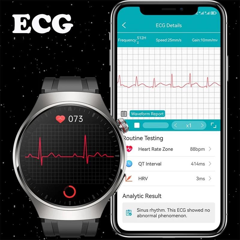 ȵ̵ OS IOS Ʈ ġ  ECG + PPG AMOLED 466*466 HD ȭ ɹڼ  ȭ, IP68  Ʈġ 2024