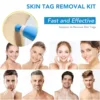 2 IN 1 Auto Skin Tag Remover Kit Micro Skin Tag Removal Device Adult Mole Stain Wart Remover Face Care Beauty Tools Dropshipping 2