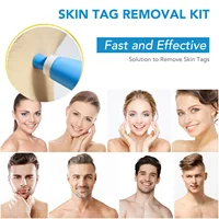 2 IN 1 Auto Skin Tag Remover Kit Micro Skin Tag Removal Device Adult Mole Stain Wart Remover Face Care Beauty Tools Dropshipping 2