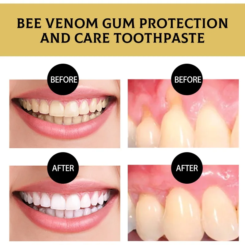 Bee Venom Gum Protection Toothpaste Removal Stains Repair Gum Dental Care Oral Cleansing Fresh Breath