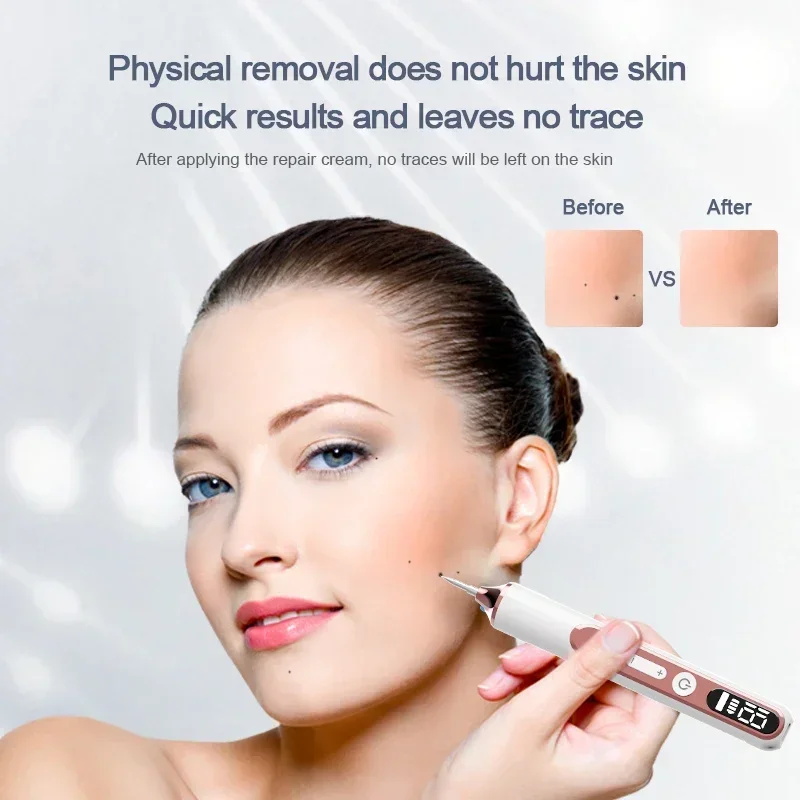 Laser Plasma Pen Needles Set Remover Skin Black Dots Laser Pen Wart Spot Freckle Tattoo Dark Nevus Flat Removal Face Skin Care