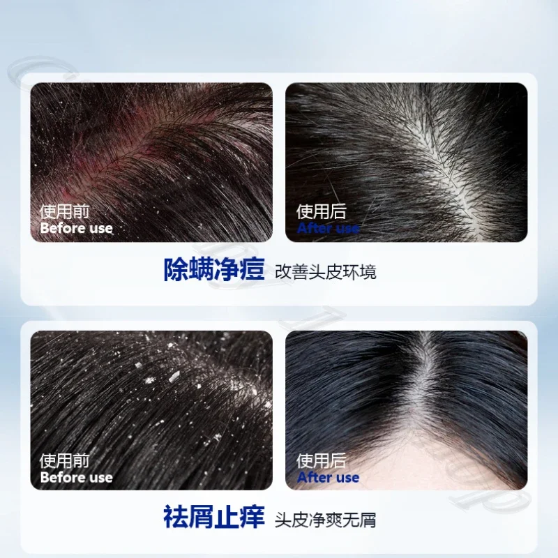440ML large capacity selenium disulfide antipruritic shampoo oil fluffy to improve the scalp environment 4