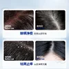 440ML large capacity selenium disulfide antipruritic shampoo oil fluffy to improve the scalp environment 4