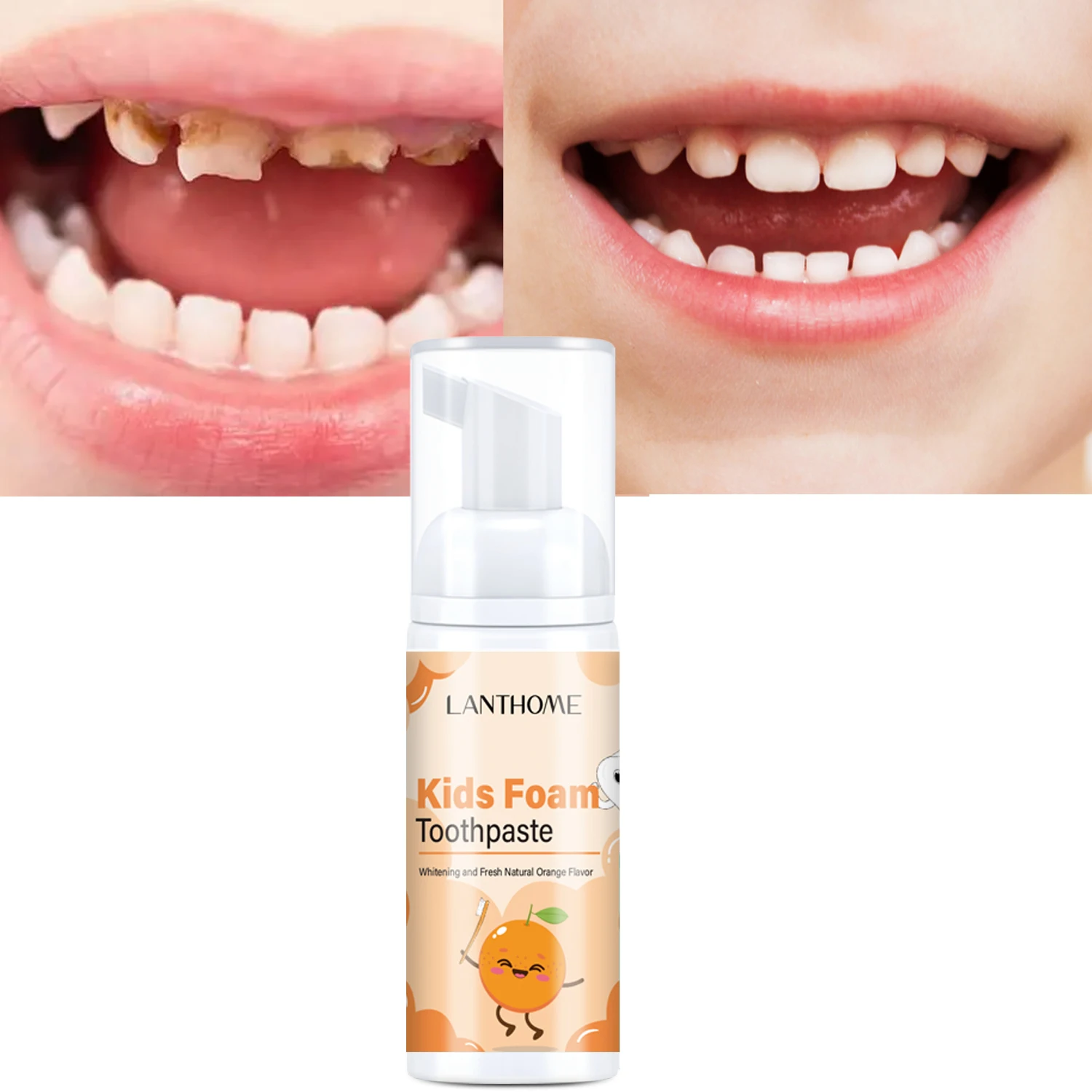 

Children Teeth Cleansing Whitening Mousse Removes Stains Teeth Whitening Oral Hygiene Mousse Toothpaste Whitening and Staining