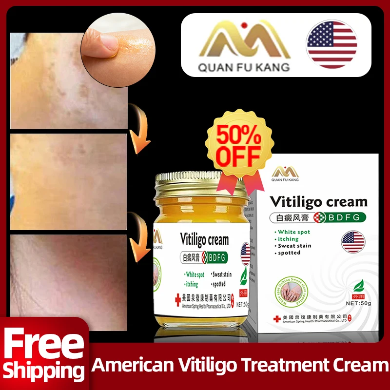 

Vitiligo Treatment Cream Skin White Spot Repair Sweat Spots Removal Spray Leg Piebald Remover Promote Melanin American Medicine