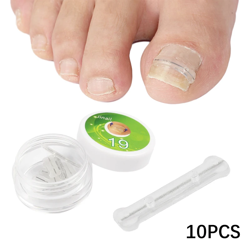 

10Pcs 13-20mm Silica Gel Nail Correction Stickers Ingrown Toenail Corrector Patches Paronychia Durable Treatment Pedicure Tools