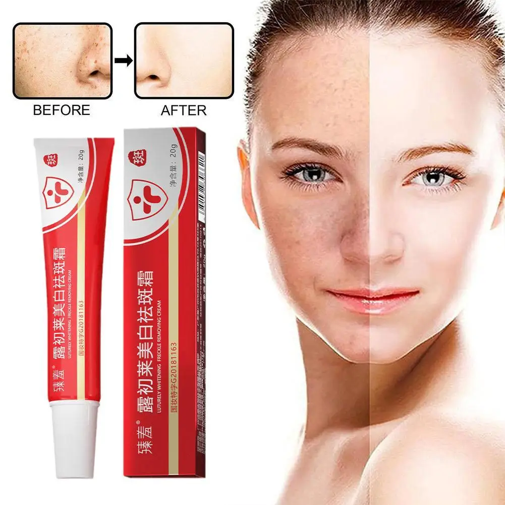 

Freckle Whitening Cream Black Dots Melasma Remover Anti Brown Stain Lighten Pigmentation Moisturizing Korean Skin Care Products