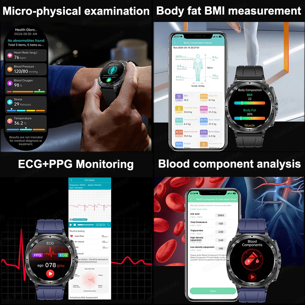 2025 New Hypertension Risk assessment ECG Smart Watch Men Precise Uric Acid Lipids Heart rate SmartWatch Old Man Health Bracelet