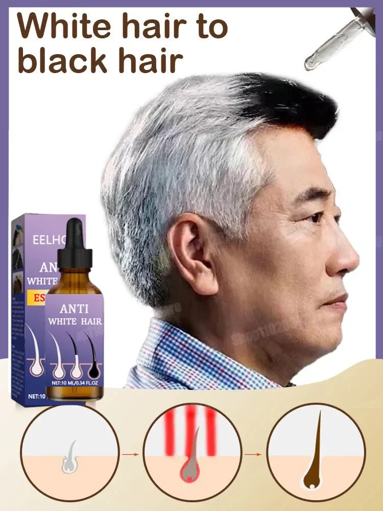 White To Black Natural Color Repair Nourishessence Anti-gray Anti Loss Care Men Women Hair Loss Product Series