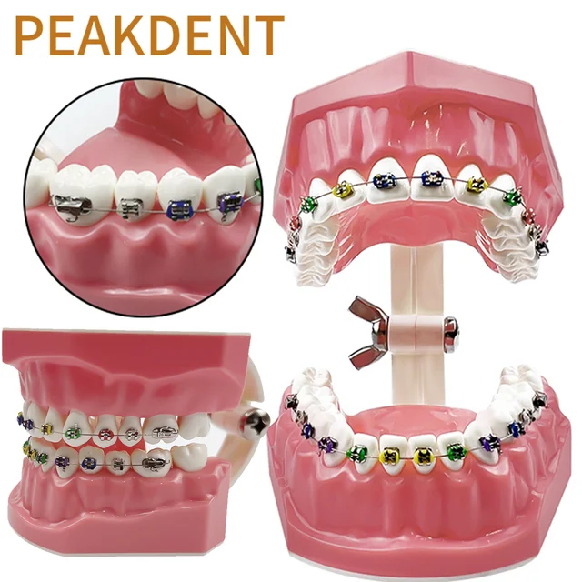 Orthodontic Dental Model With Bracket Braces Typodont 1:1 Teeth Model Orthodontic Treatment Model Typondont Jaw Model