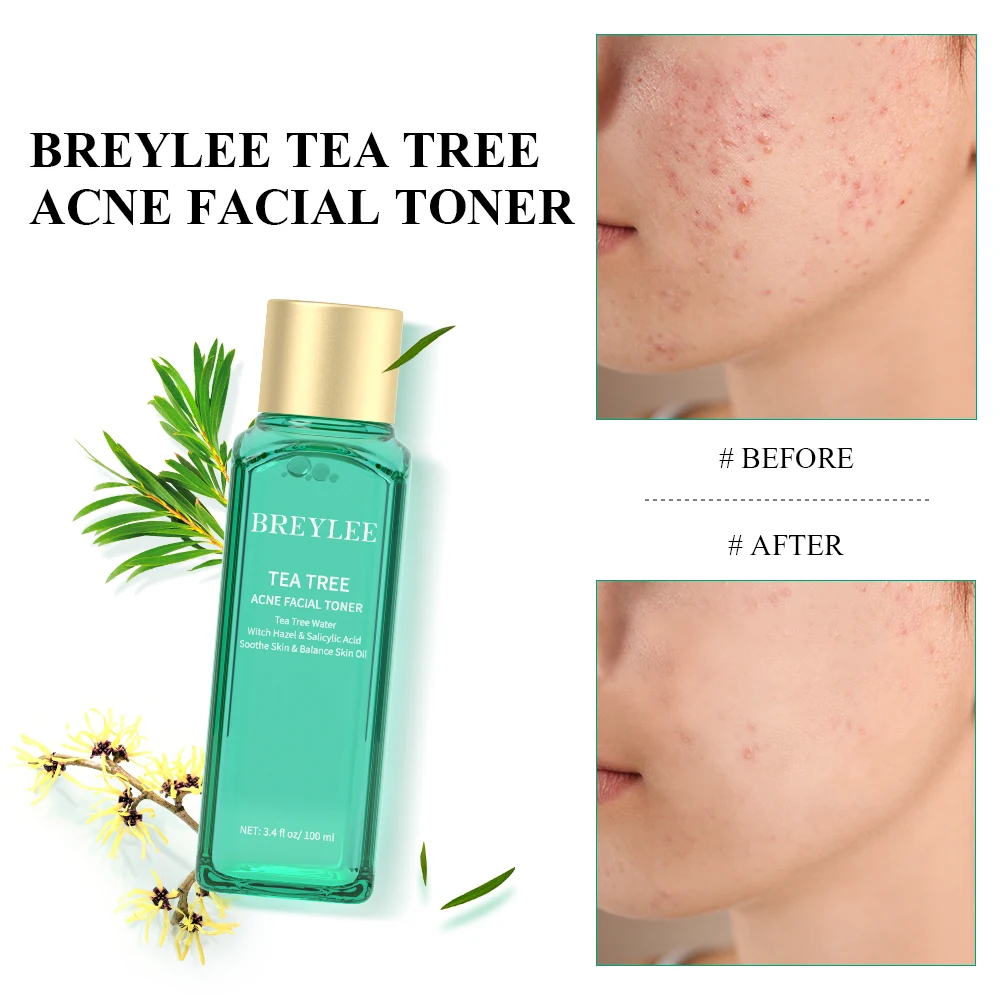 BREYLEE Facial Toner Tea Tree Essence Acne Removal Soothing Cleansing Oil Moisturizing
