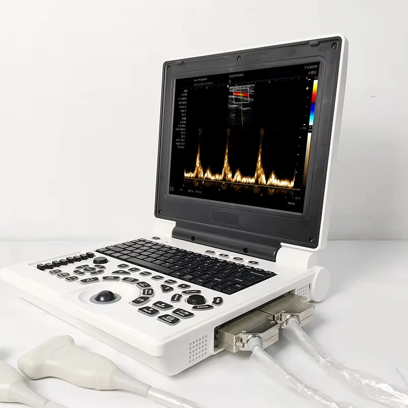 Ultrasound Scanner Veterinary for Pregnancy, Vet Portable B-Ultra Sound Scanner