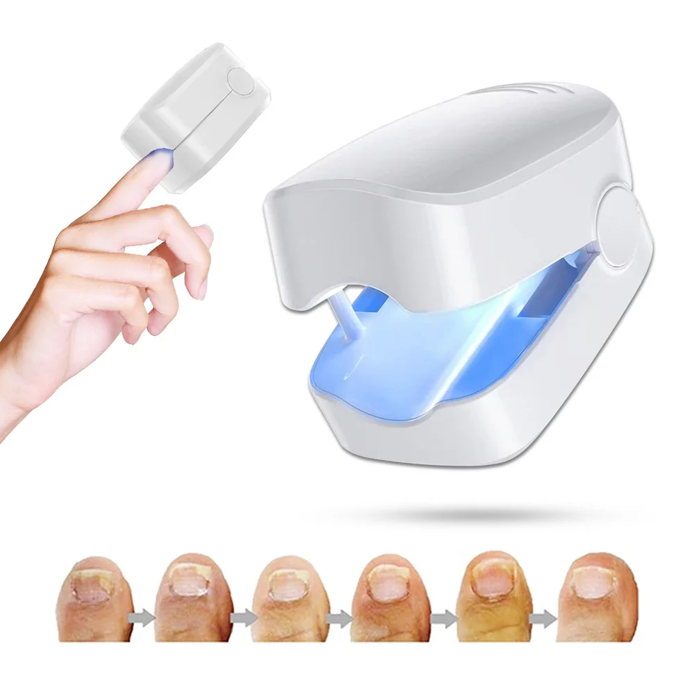 

Лазерное устройство для очистки ногтей от онихомикоза, Лазерное Лечение грибка ногтей для ногтей, Лечение грибка ногтей на ногтях