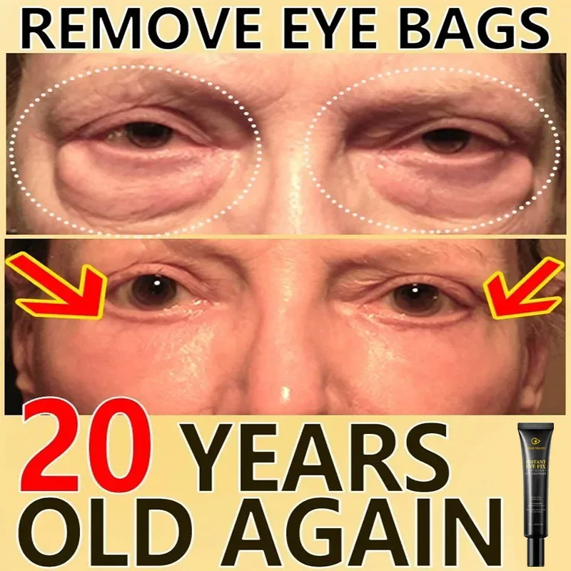 Eye Cream Removes Dark Circles Tightens Eyes Lifting Firming Removing Eye Bags
