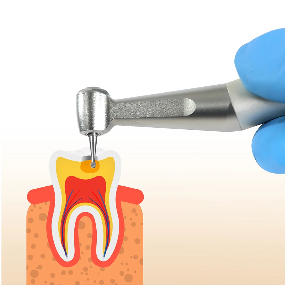 aço burs diamante burs broca ra 2.35mm