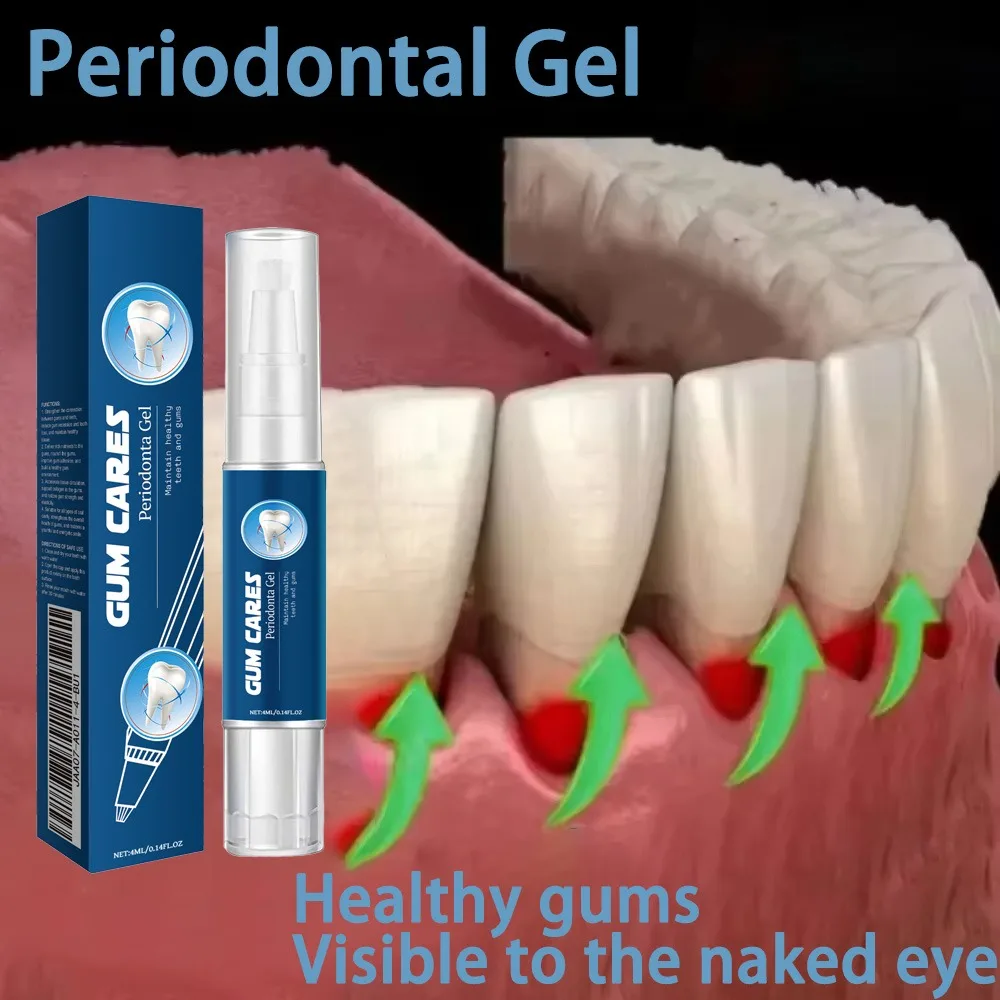 Damaged Gum Repair Care Gel Relieve Sore Gums Allergy Deep Cleaning Teeth Stains Tartar Serum Dental Caries Toothpaste gum repair drops dental calculus remover teeth health product oral hygiene tongue gel