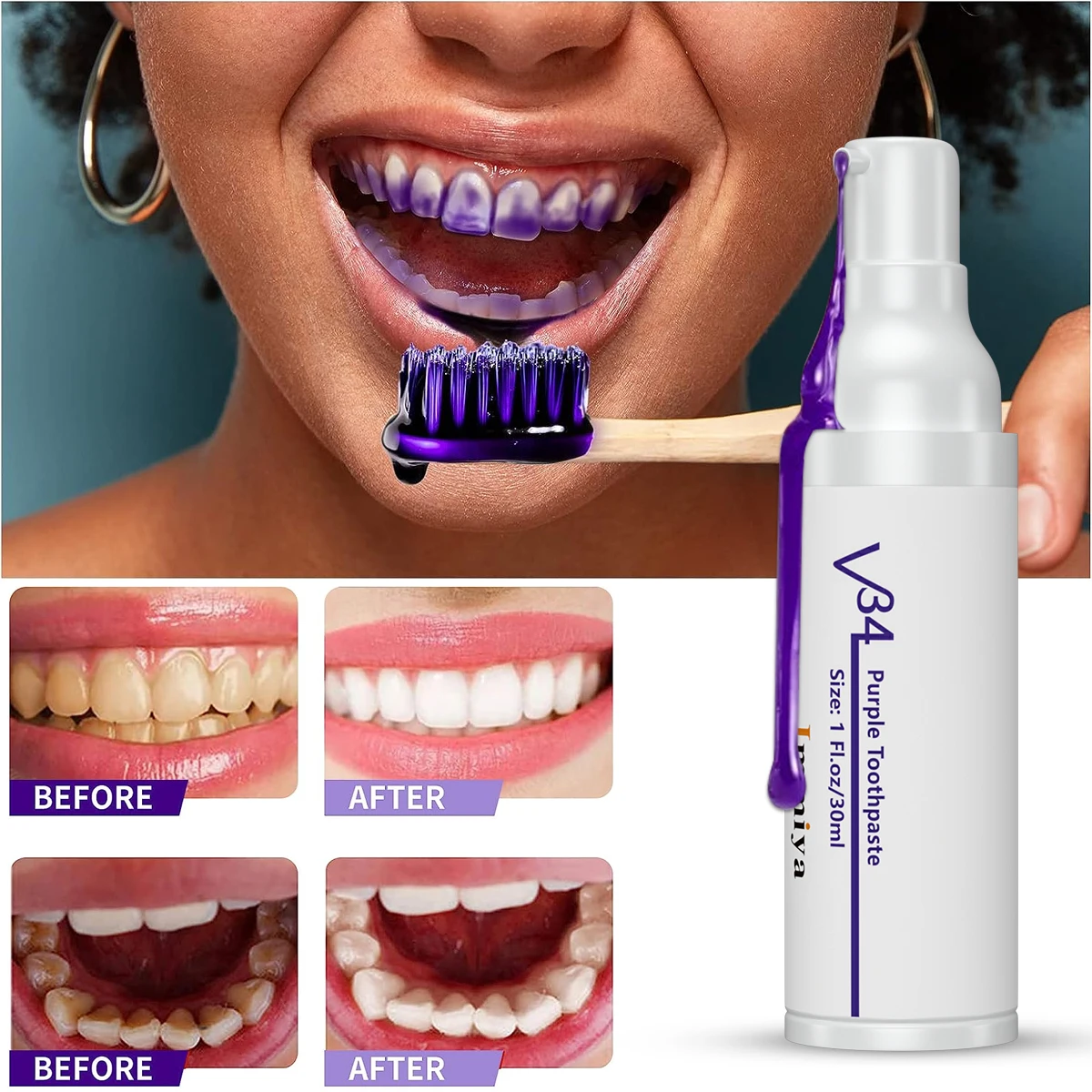 

Teeth Whitening Toothpaste Serum Toothpaste Teeth Mousse Smile Kit Reduce Yellowing Oral Refreshing 30ml
