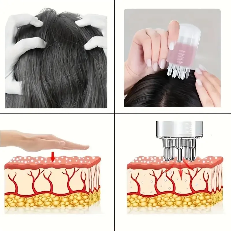 hair comb Essential Oil Massage Hair Generation Massage Comb Scalp Guide Liquid Applicator Head Health