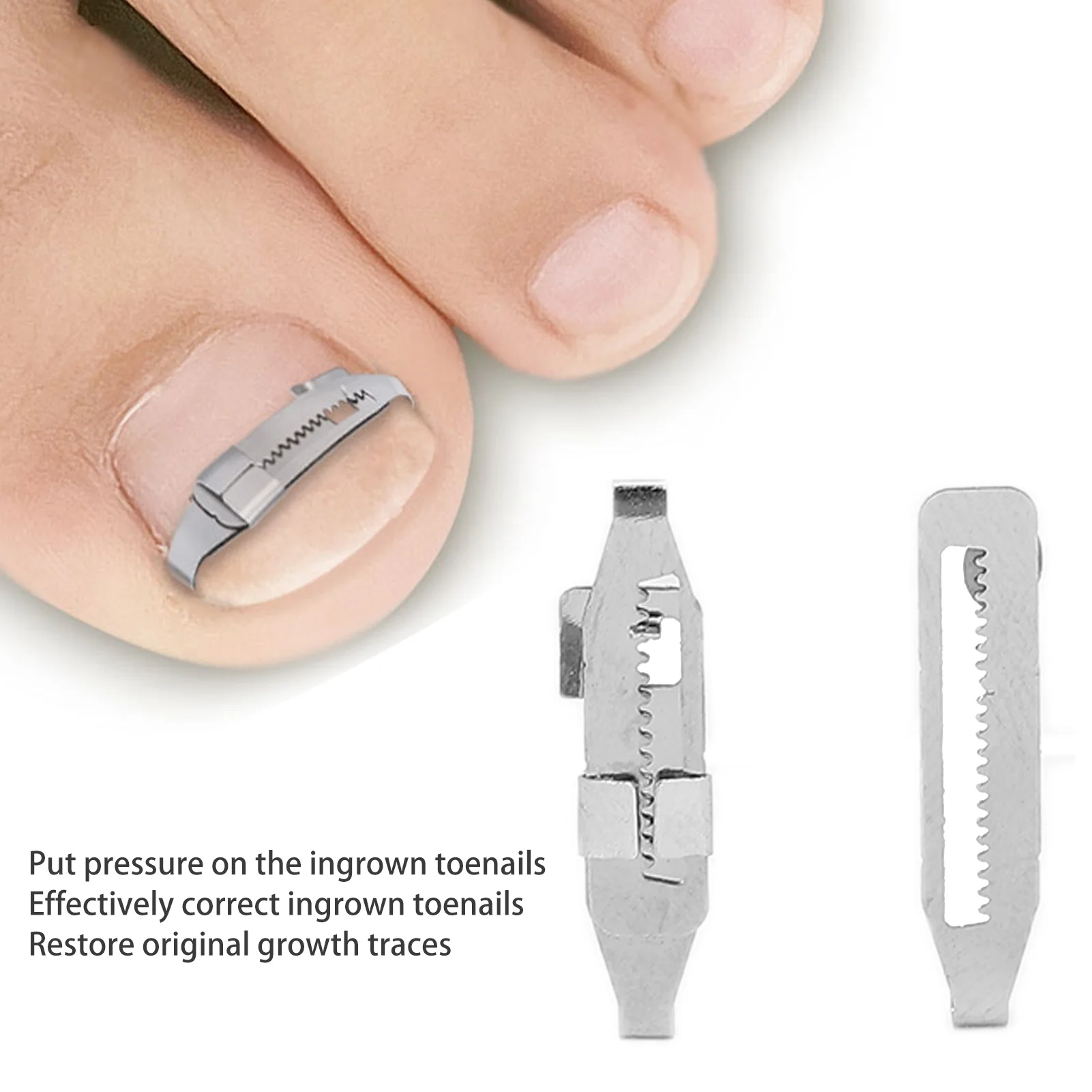 2pcs Ingrown Toe Corrector Stainless Steel Straightening Pedicure Tool For Paronychia Treatment