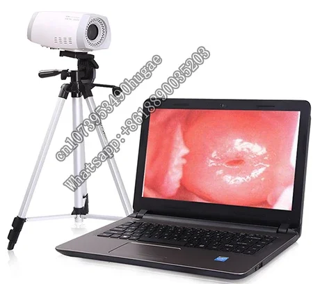 

Digital Device HD Video Vaginal For Gynecology