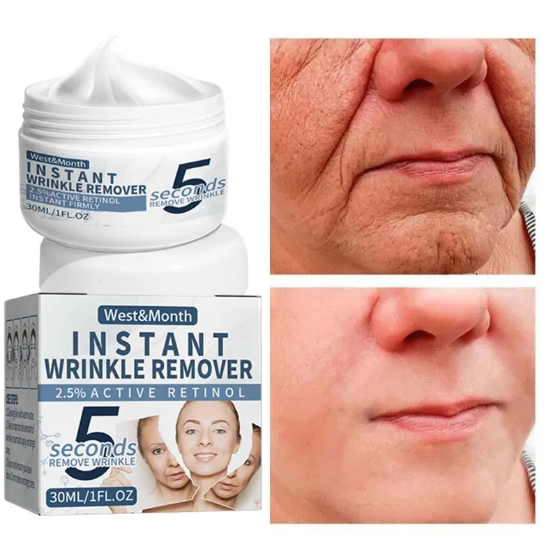 

Retinol Wrinkle Removing Face Cream Anti-Aging Firming Lifting Fade Fine Lines Repair Product Moisturizing Brightening Skin Care