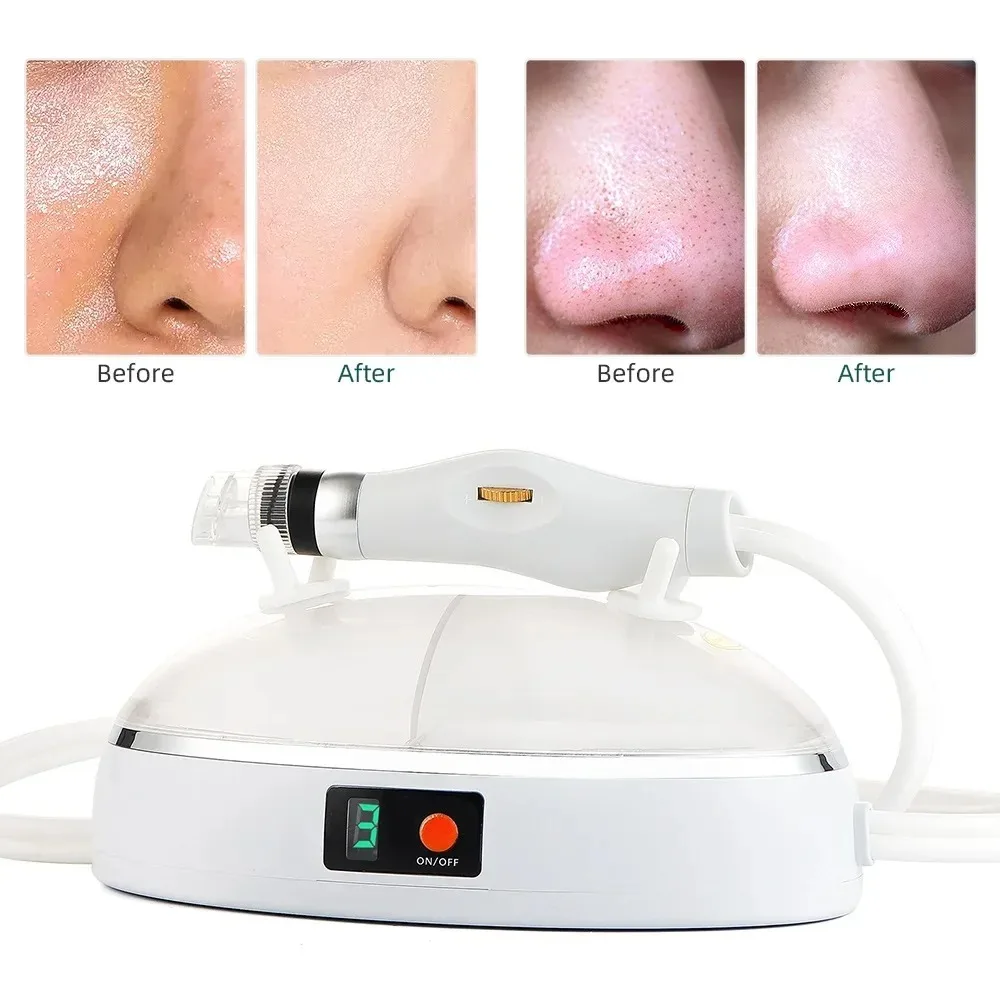 New Hydra Face Care Device for Skin Moisturizing Vacuum Cleaning Jet Small Bubbles Blackheads Remover Suction Tool Pore Cleaner 3