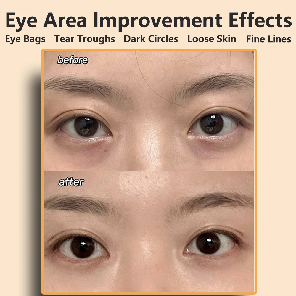 Eye massager Ems pulse microcurrent eye care device to relieve fatigue massage reduce dark circles swelling anti-wrinkle