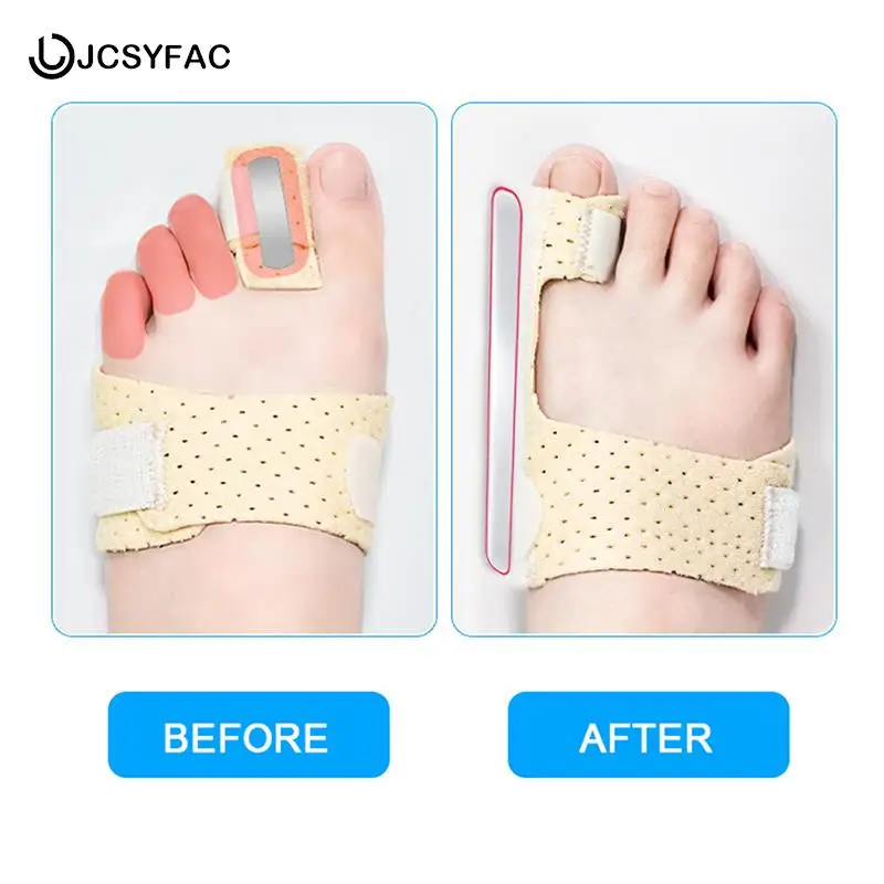 1 Pz Regolabile Hammer Toe Raddrizzatore Correttore Per Metatarsalgia Claw Toe Mallet Toe Sollievo Dal Dolore Stecca Foot Compression Wrap