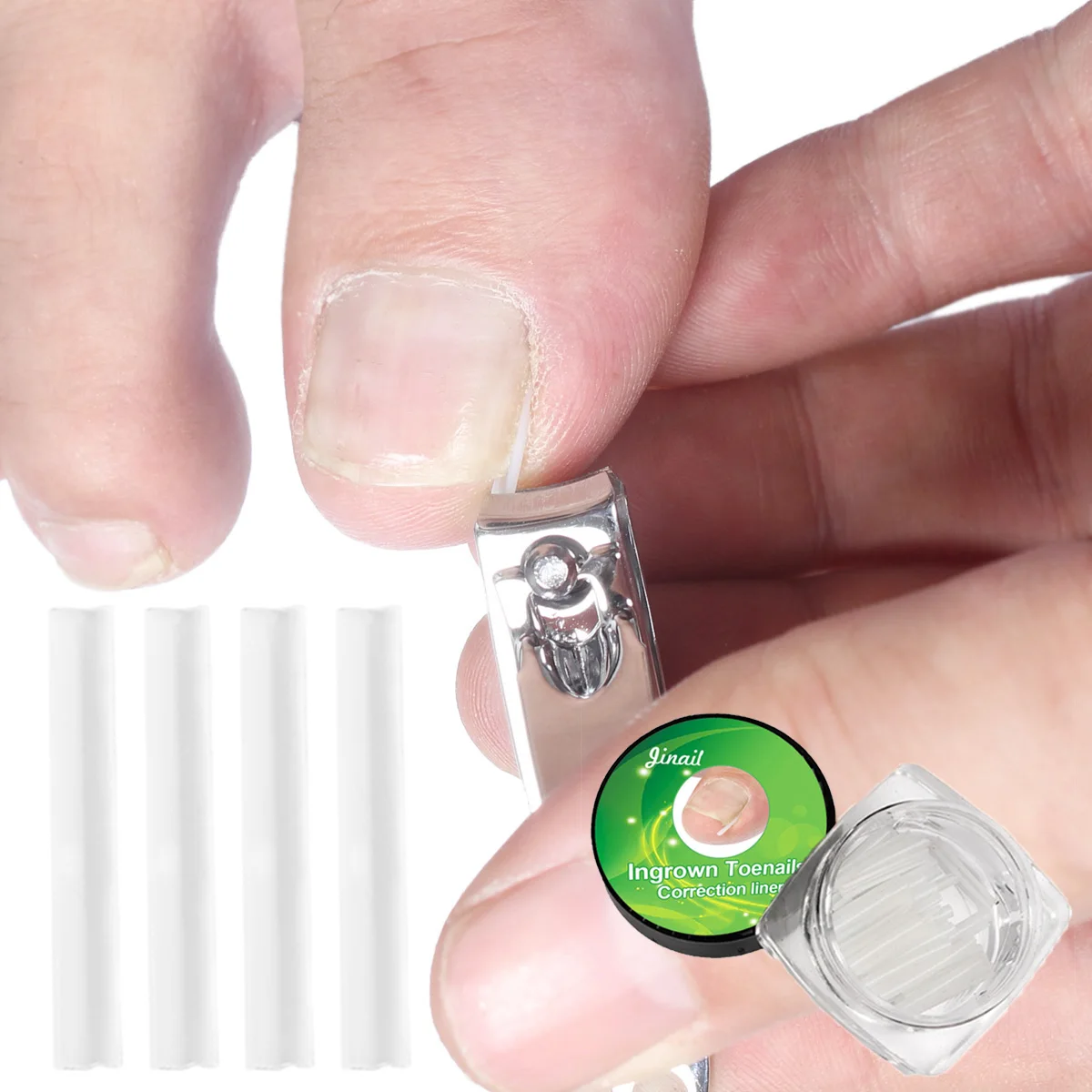 10pcs Ingrown Toenail Correction Tool Ingrown Toe Nail Treatment