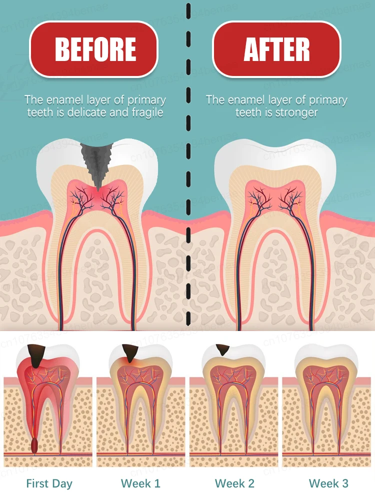 Probiotic Toothpaste Solves Tooth Gum Pain Prevents Dental Problems Whitens Teeth