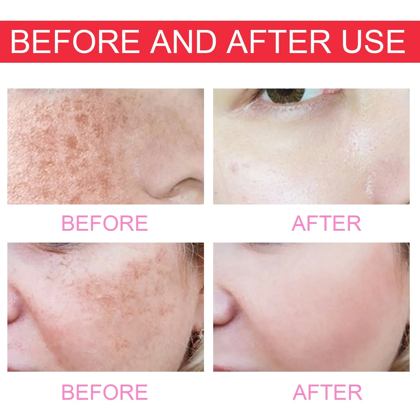50ml Eelhoe Brightening Dark Spot Essence Moisturizing Hydrating Repairing Skin Shrink Pores