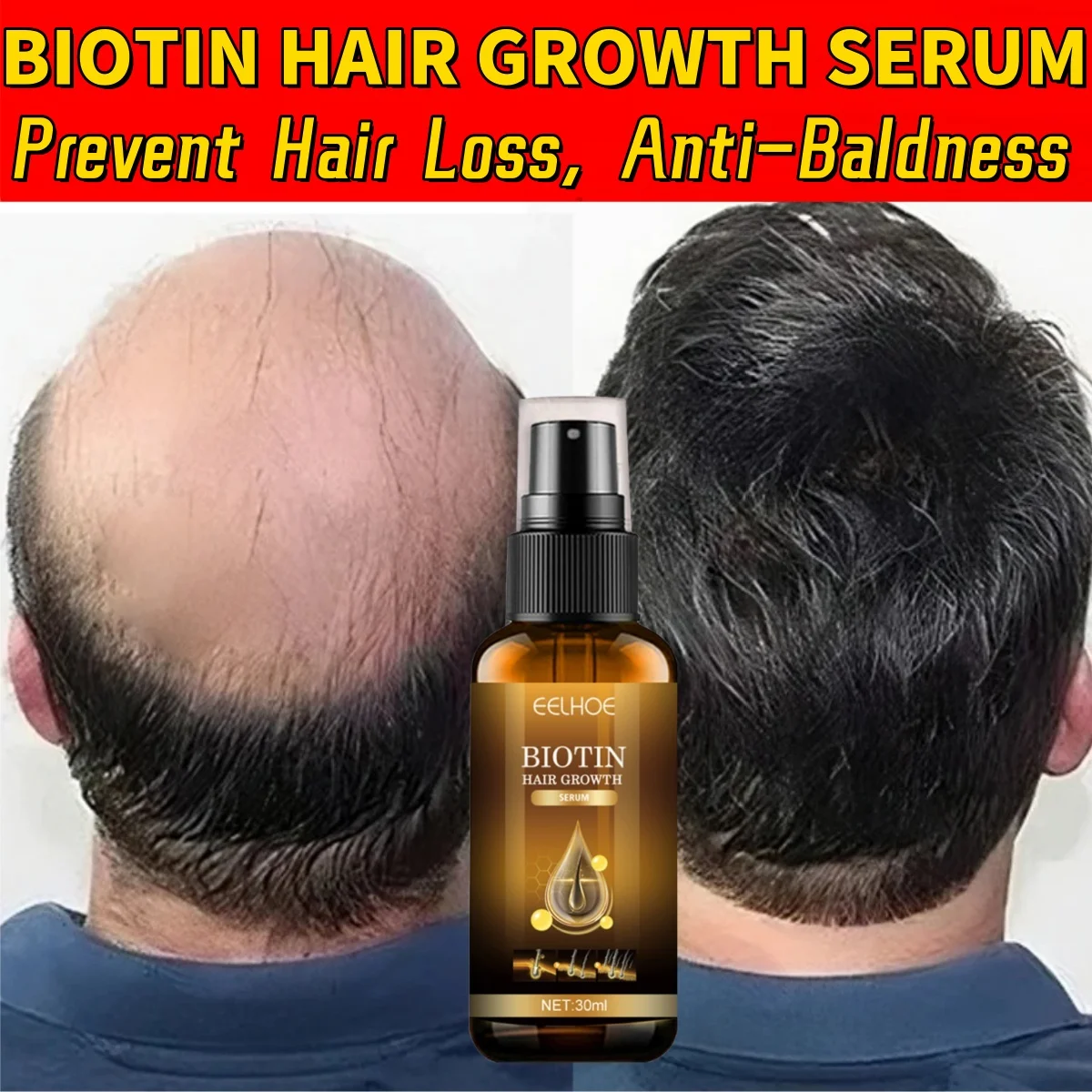 

30ml Fast Hair Regrowth Spray Essential Oil Prevent Hair Loss Anti-Baldness Scalp Nourishing Damaged Repair Strengthen Hair Care